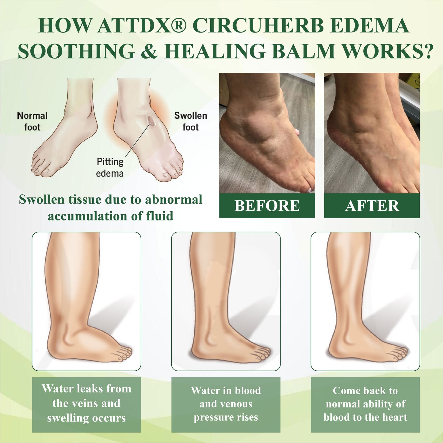 CircuHerb Βάλσαμο Καταπράυνσης & Επούλωσης για Οίδημα