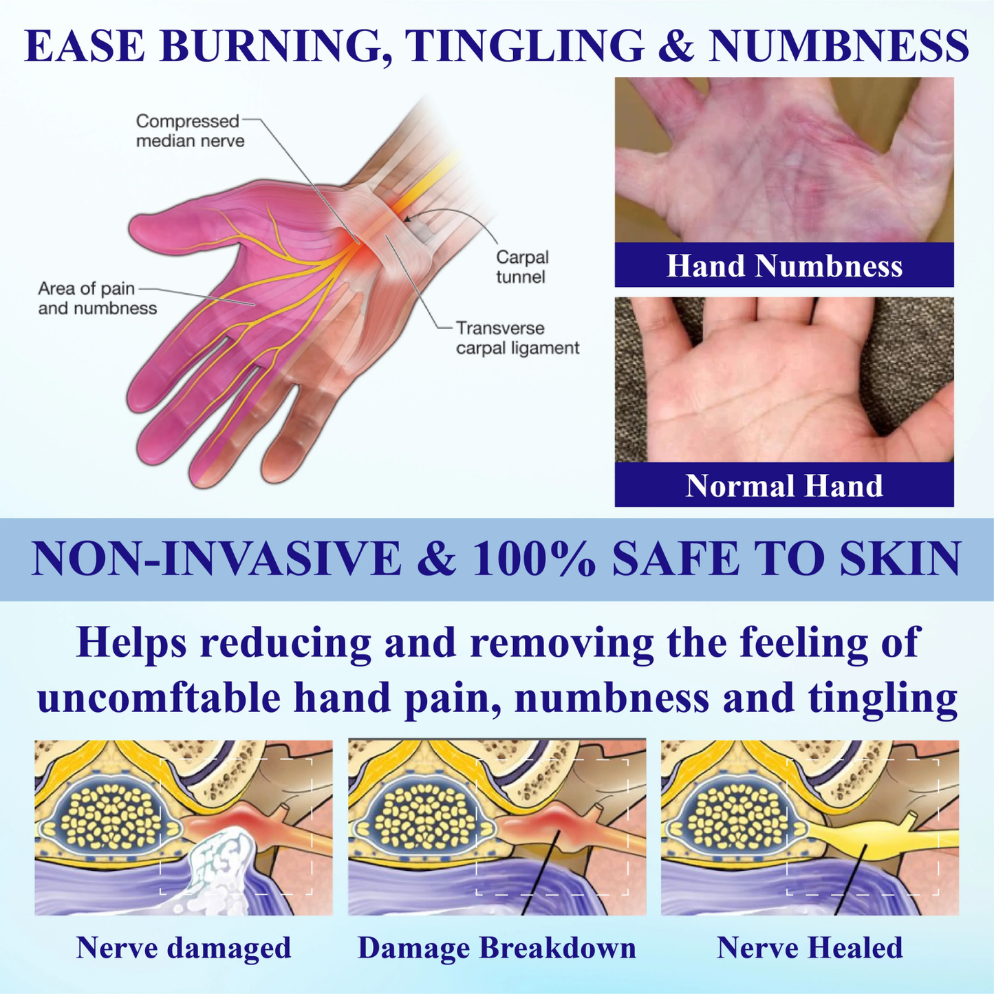 Σπρέι Για Ανακούφιση Νευροπάθειας