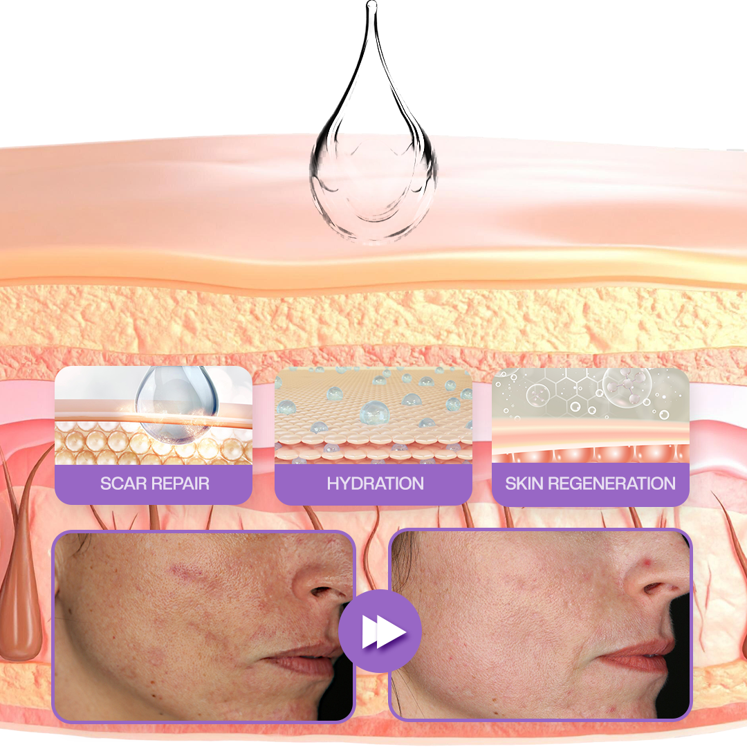 Τζελ RevivaDerma για Ουλές Προσώπου & Σώματος