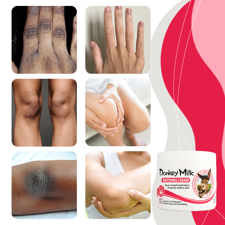 SnowBleach™  Λευκαντική Κρέμα Σώματος