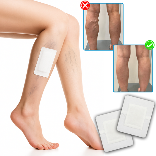 Timilk® LegRenew Έμπλαστρα Για Κιρσούς