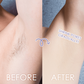 BodyGlow Ηλεκτρική Ξυριστική Συσκευή