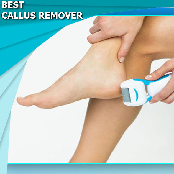 CallusRemover Ηλεκτρική Συσκευή Αφαίρεσης Κάλων