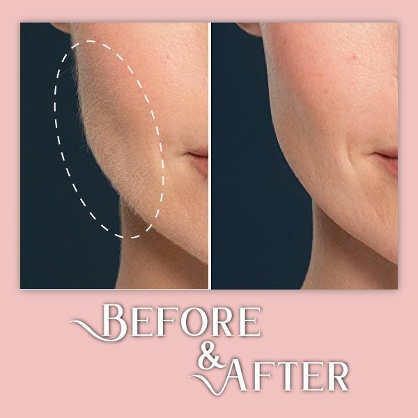 FaceCare Επαγγελματική Συσκευή  Περιποίησης Προσώπου